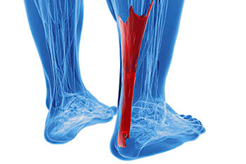 Achilles tendonitis treatment in the Queens County, NY: Ozone Park (Forrest Hills, Howard Beach, Jamaica, East New York, Hollis, Laurelton, Flushing, Elmhurst, Elmont, Bushwick, Williamsburg) and Nassau County, NY: Manhasset (Great Neck, Garden City, Mineola, Westbury, Roslyn, Jericho, Hempstead, Hicksville, Glen Cove, East Meadow) areas