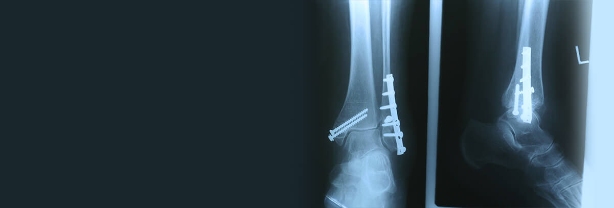 Digital X-Ray in the Ozone Park, NY 11416 and Manhasset, NY 11030 areas
