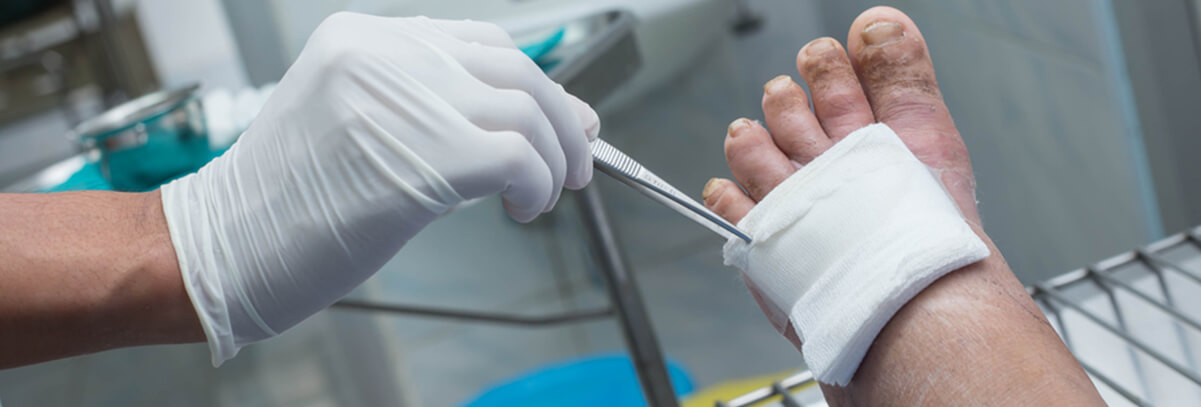 Diabetic Foot Care in the Ozone Park, NY 11416 and Manhasset, NY 11030 areas