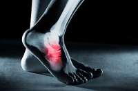 Where Your Foot Pain May Be Coming From