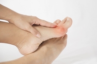 Bunion Symptoms and Complications