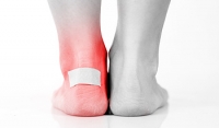 What Causes Blisters and Why They Form