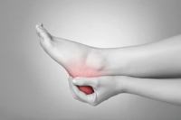 Excessive Running or Jumping May Cause a Bruised Heel