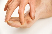 The Right Shoes may Make a Difference for Bunions